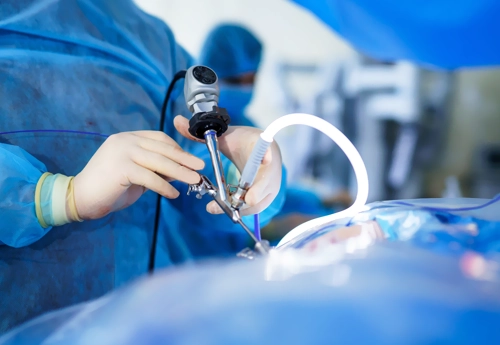 Prostate Cancer Surgery (Radical Prostatectomy)